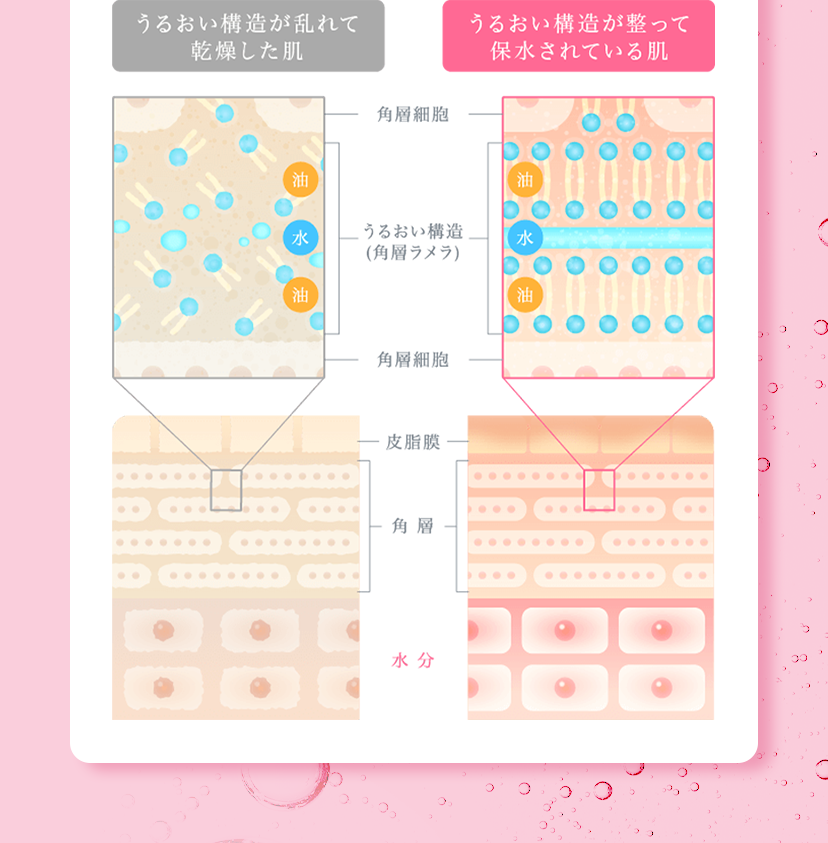 うるおい構造が乱れて乾燥した肌とうるおい構造が整って保水されている肌の違い